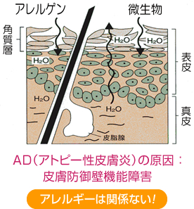 �A�����Q�� - ������ - �p���w - �玉�� - �\�� - �^�� - AD�i�A�g�s�[���畆���j�̌����F�畆�h��ǋ@�\��Q - �A�����M�[�͊֌W�Ȃ��I