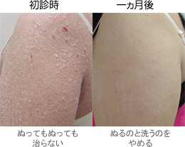 ���f�� - �ʂ��Ă��ʂ��Ă�����Ȃ� - �P������ - �ʂ�̂Ɛ􂤂̂���߂�