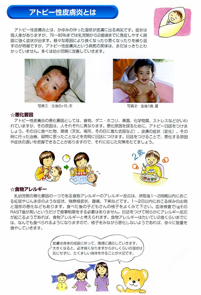 アトピー性皮膚炎ってなあに