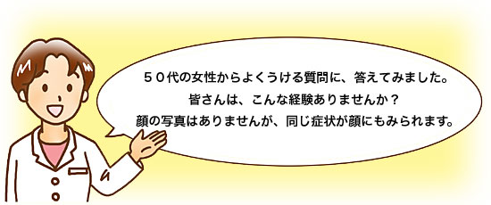 ５０代の女性からよくうける質問に、答えてみました。皆さんは、こんな経験ありませんか？顔の写真はありませんが、同じ症状が顔にもみられます。