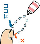 外用薬 ローション